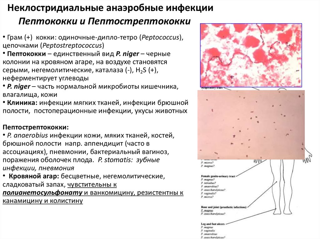 Анаэробные условно патогенные