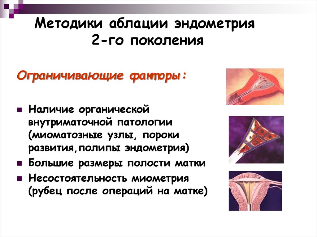 Высокая эндометрия. Методики аблации эндометрия. Аблация эндометрия показания. Лазерная аблация эндометрия.