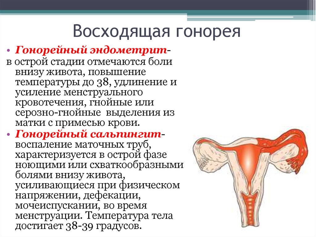 Как выглядит гонорея фото