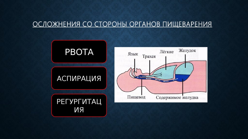 Мультимодальная анестезия презентация