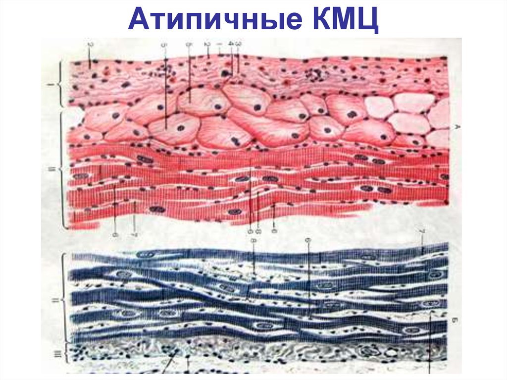 Эндокард рисунок гистология