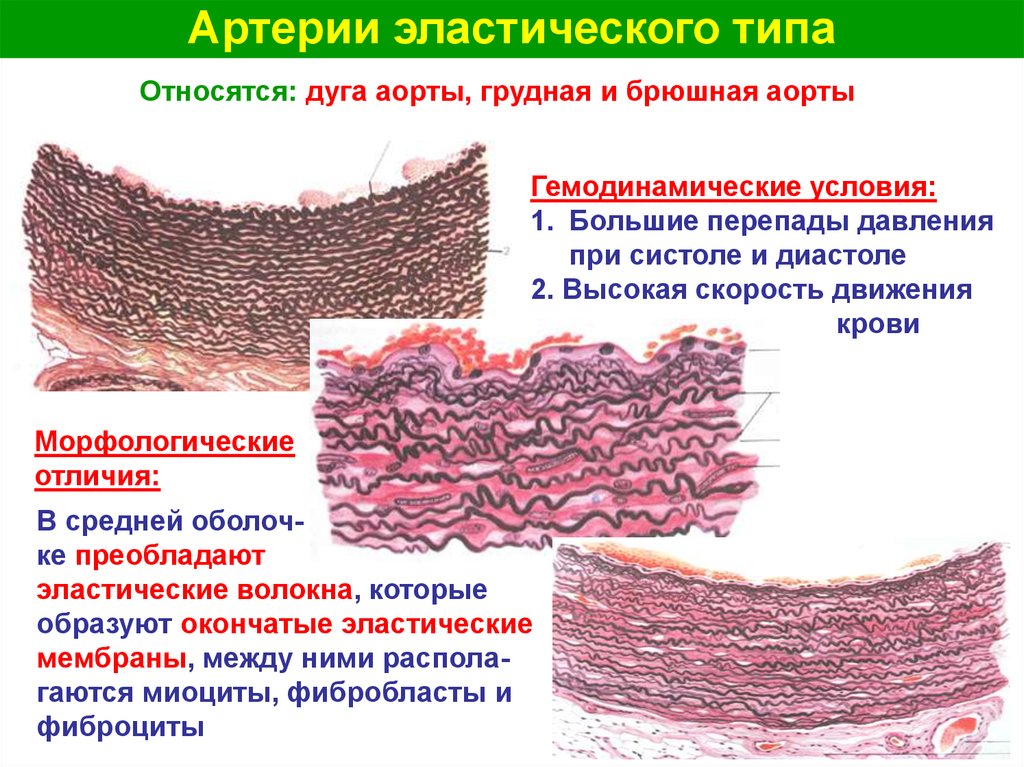 Наличие толстой мышечной стенки и мелких камней. Строение артерий эластического типа. Строение артерий мышечного и эластического типа. Строение артерии эластического типа гистология. Строение стенки артерии гистология.