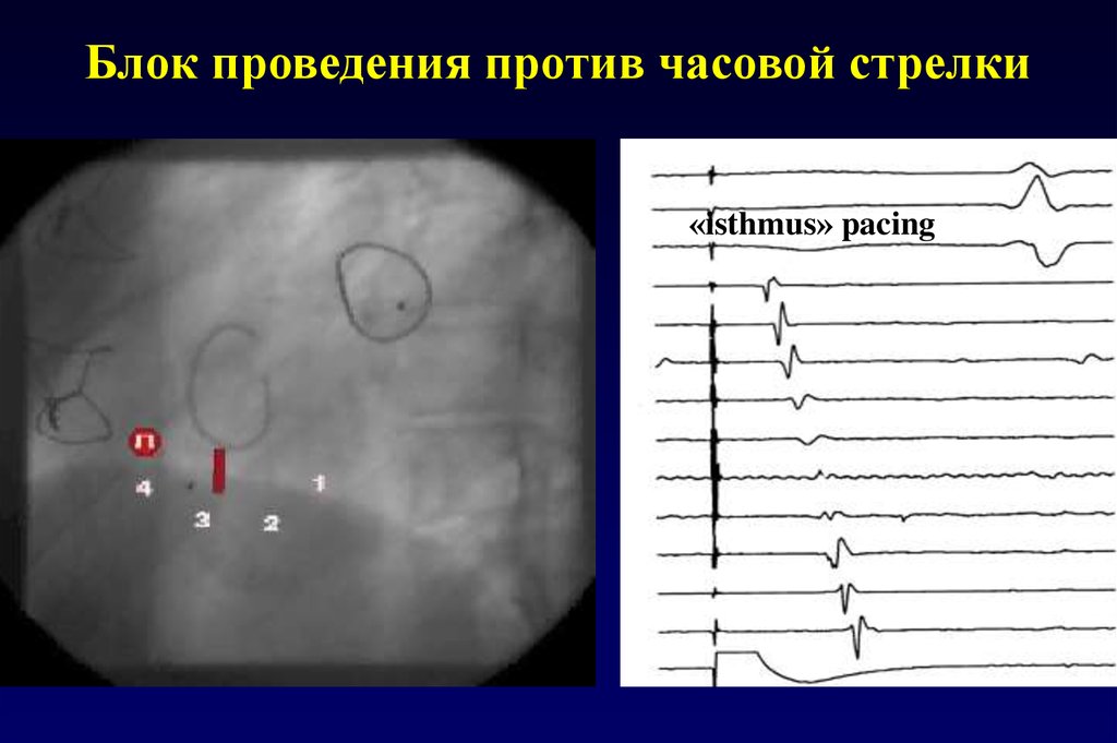 Блоки проведения. Блок проведения.