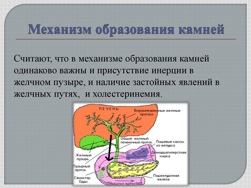 Причины образования камней в желчном пузыре. Желчнокаменная болезнь механизм камнеобразования. Механизм образования желчных камней. Механизм формирования желчных камней. ЖКБ механизм образования камней.