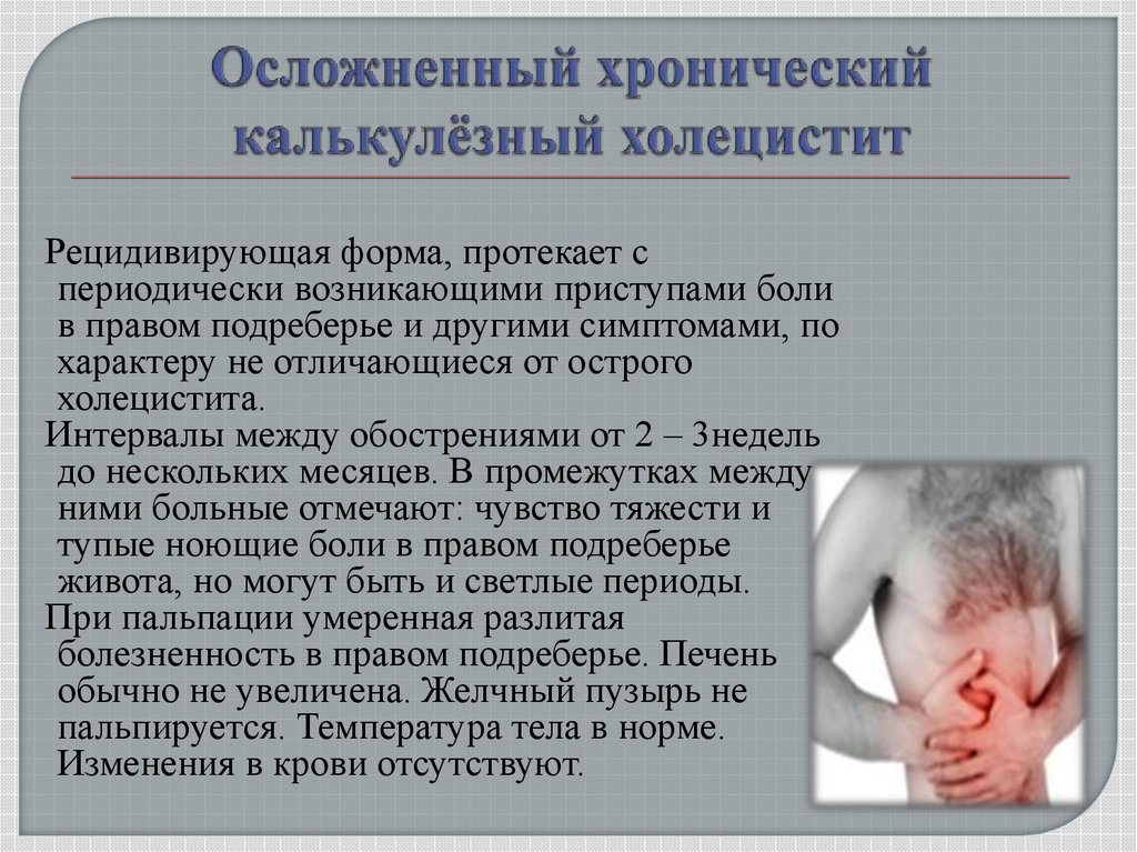 Презентация калькулезный холецистит