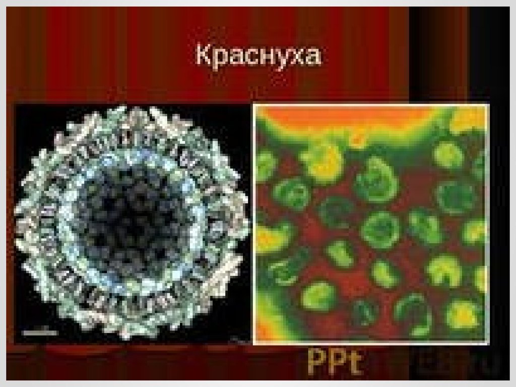 Рубелла вирус что. Коревая краснуха возбудитель. Вирус коревой краснухи. Возбудитель краснухи фильтрующий вирус. Нейраминидаза краснуха.