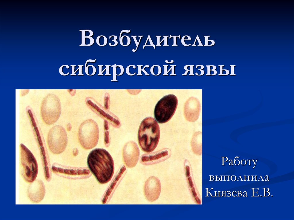 Возбудитель сибирской язвы. Сибирская язва возбудитель. Споры возбудителя сибирской язвы. Возбудитель сибирской язвы язвы. Сибирская язва животных возбудитель.