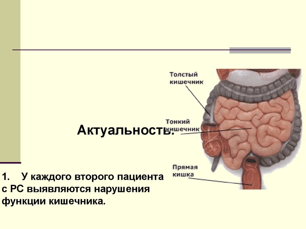 Образования тонкой кишки