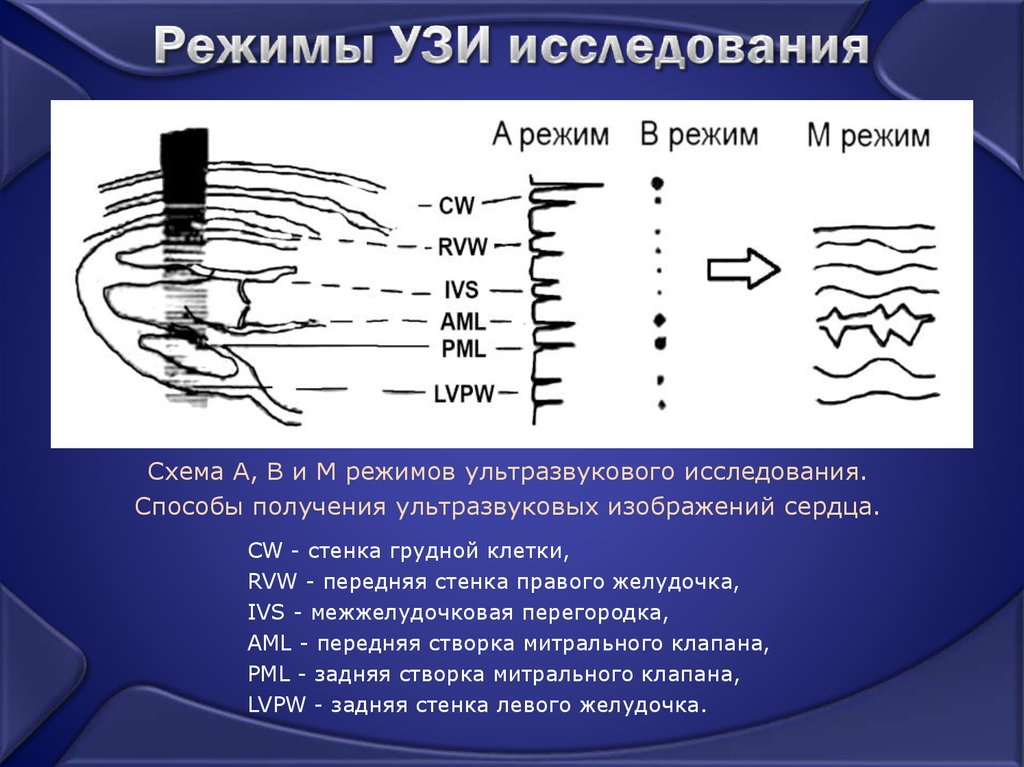 Изображение при узи получают