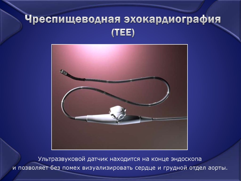 Чреспищеводная эхокардиография (TEE)