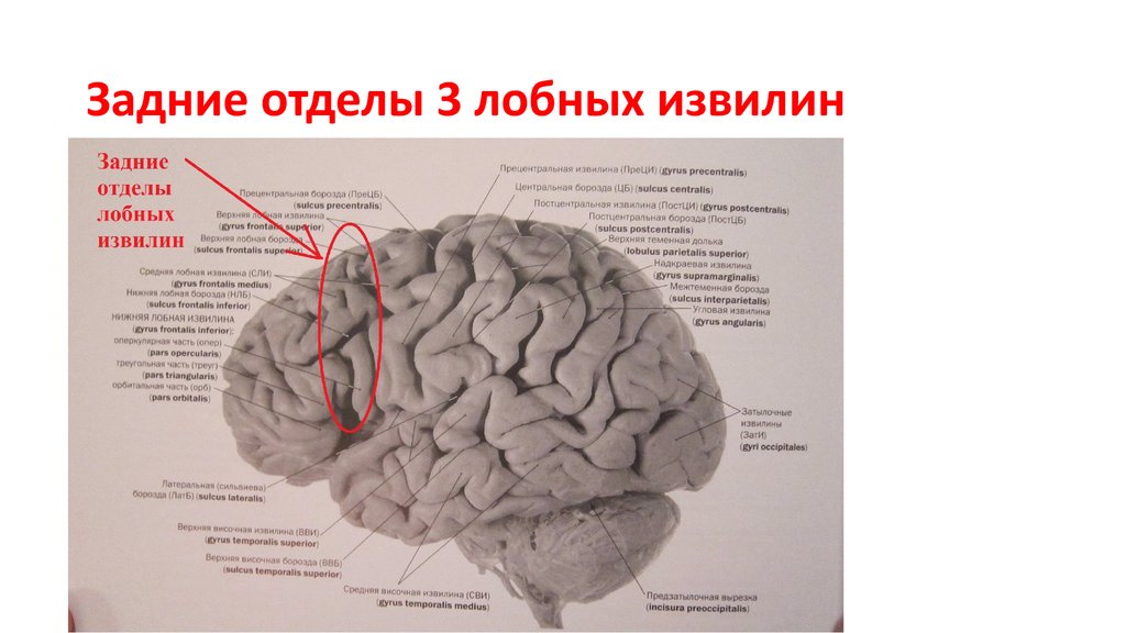 Центральная извилина мозга. Задний отдел средней лобной извилины. Задний отдел нижней лобной извилины. Задний отдел верхней лобной извилины. Задняя Центральная извилина.