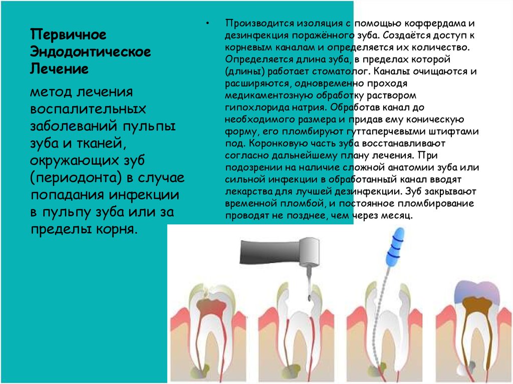 После эндодонтического лечения. Эндодонтические методики. Методы обработки корневых каналов зубов.