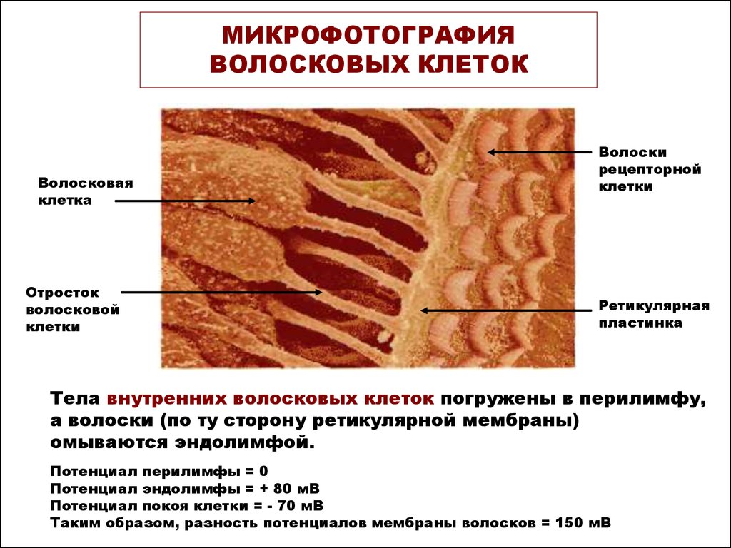 Волосковые клетки в ухе. Внутреннее ухо строение волосковые клетки. Микрофотография волосковых клеток. Волосковая клетка внутреннего уха строение. Наружные и внутренние волосковые клетки функции.