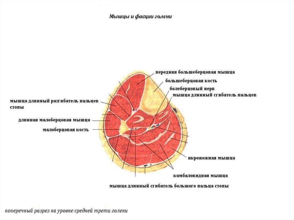 Поперечный распил голени схема