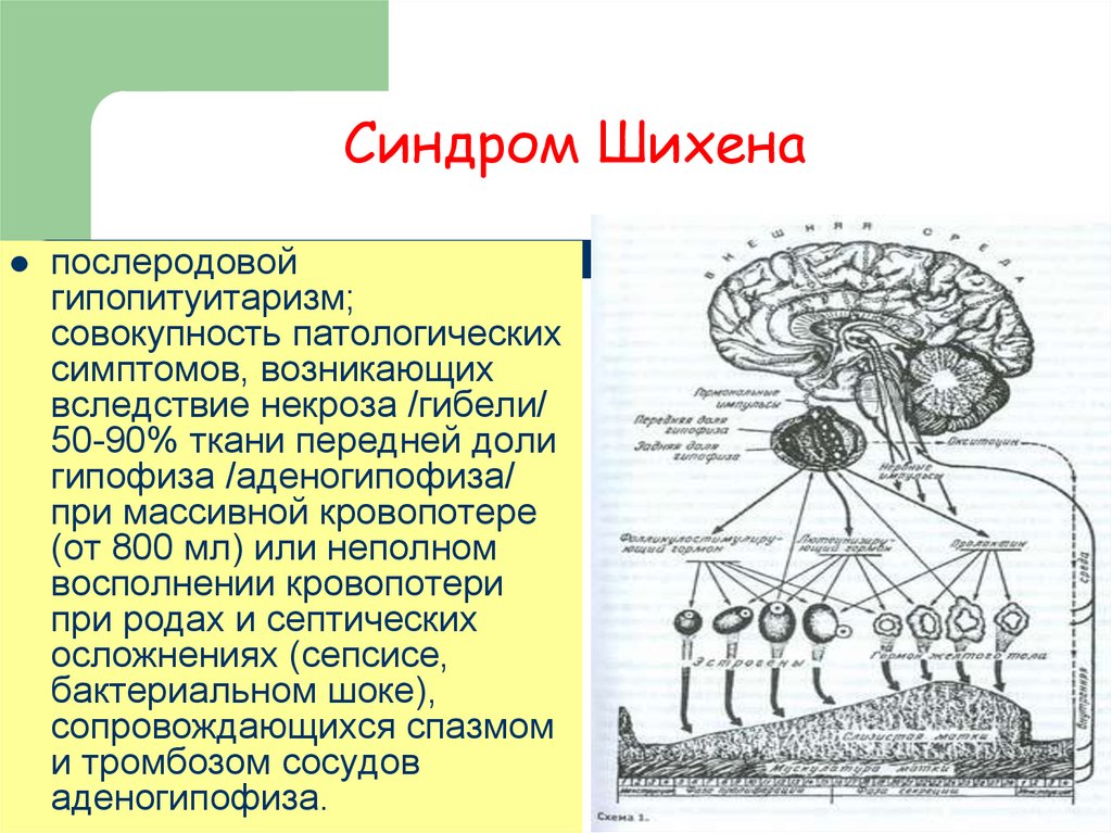 Синдром шиена презентация