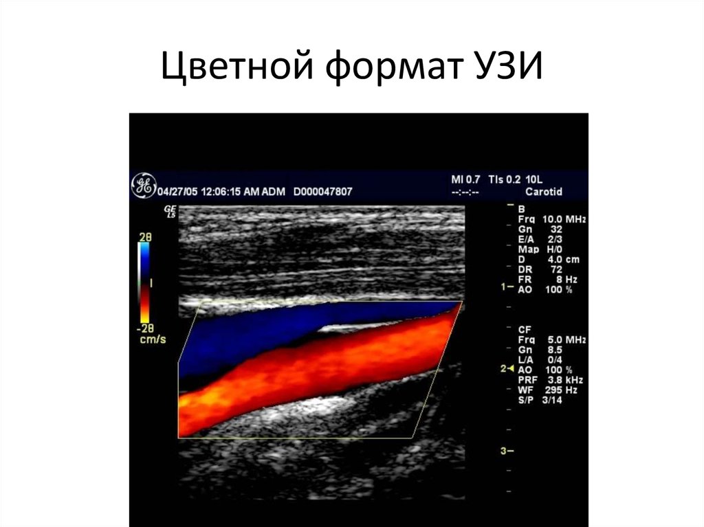 Презентация про узи