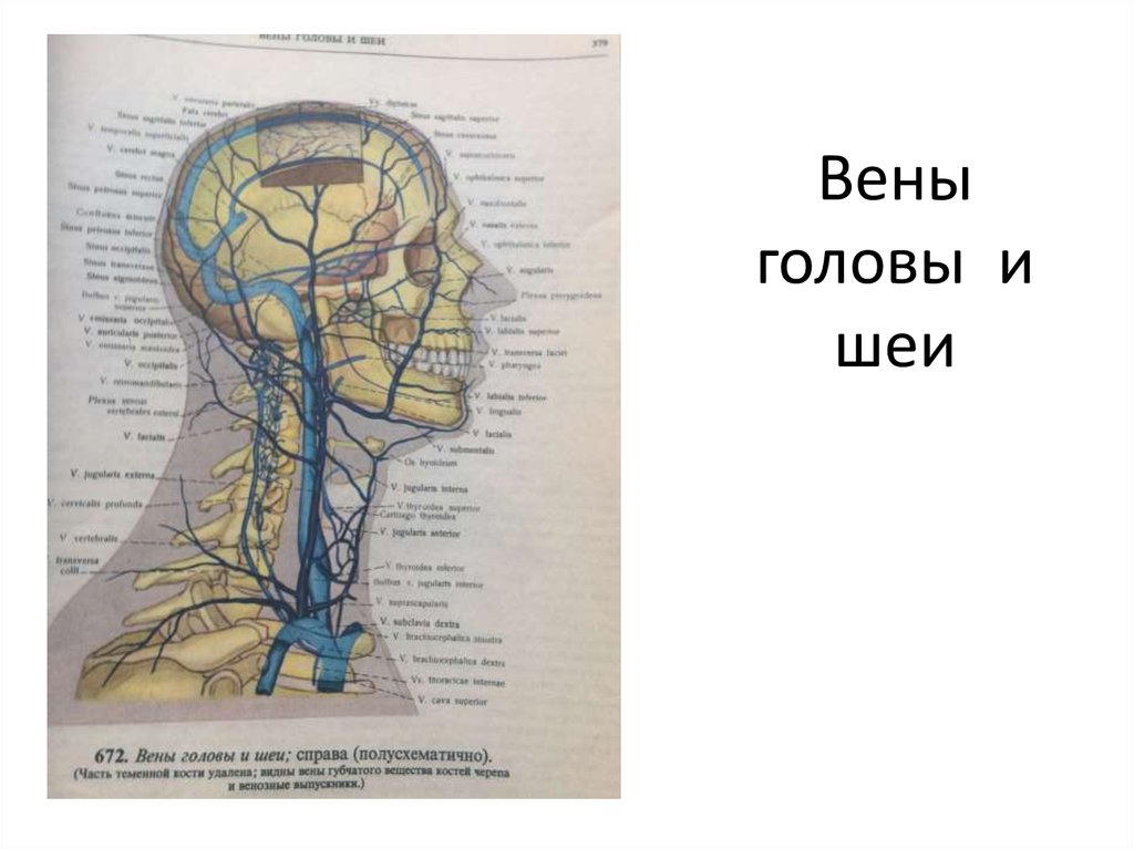 Верхние вены мозга. Вены головы и шеи верхняя полая Вена. Поверхностные вены головы и шеи анатомия. Вены головы и шеи анатомия схема. Подкожные вены шеи анатомия.