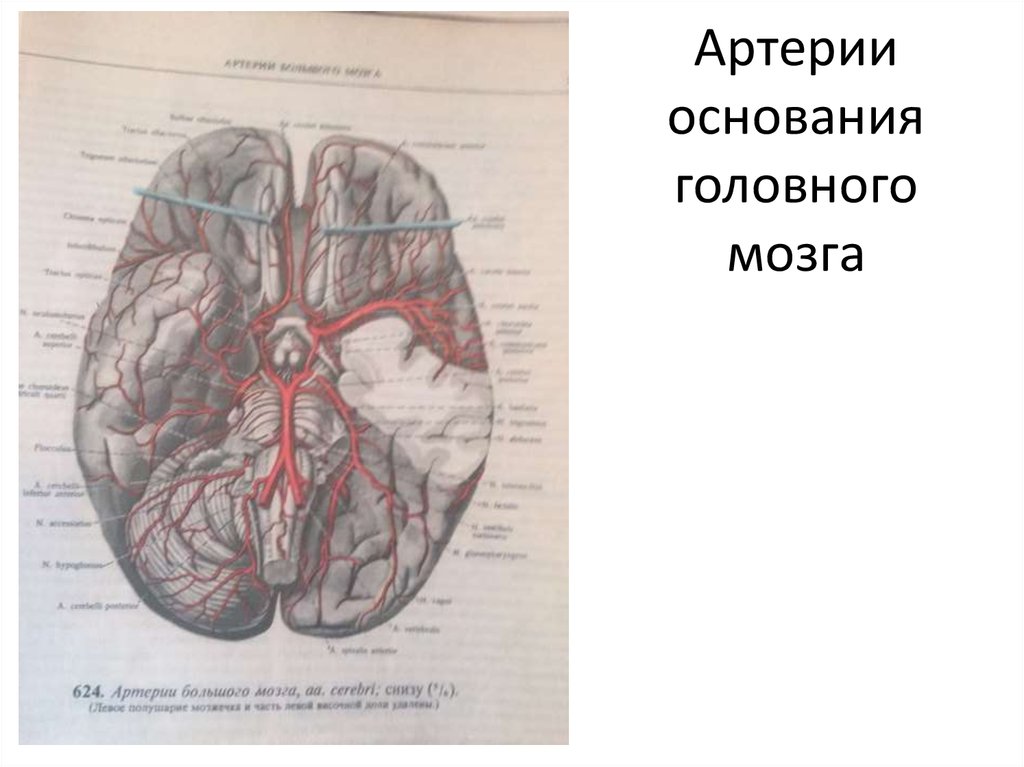 Артерии основания головного мозга