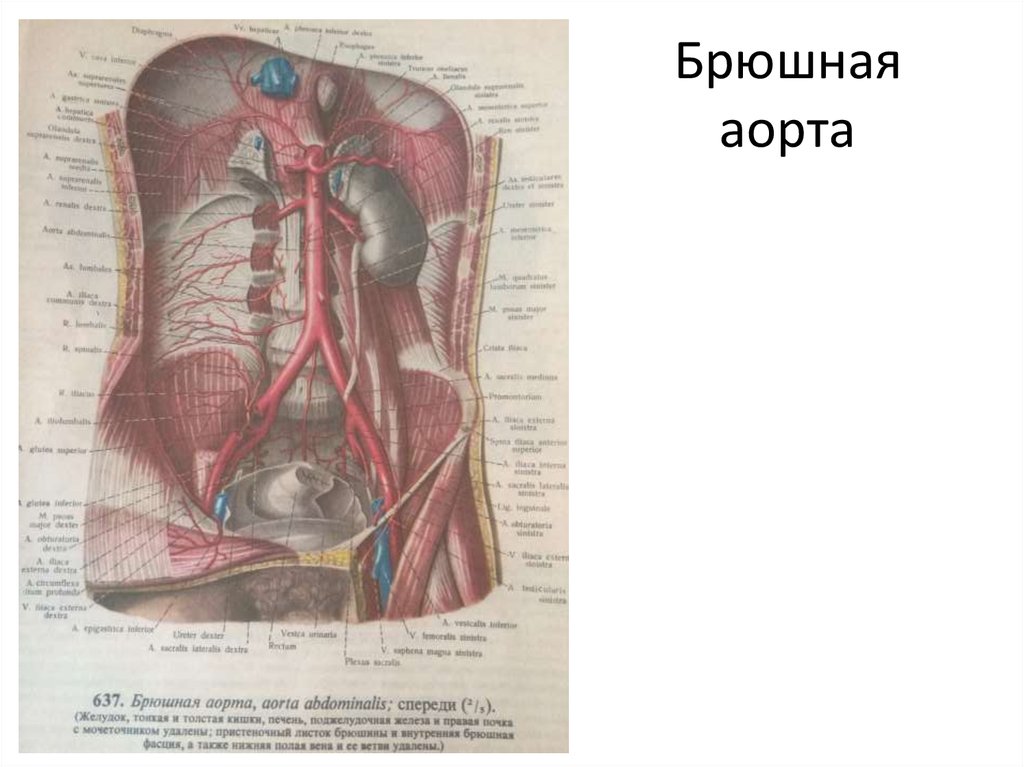 Презентация брюшная аорта