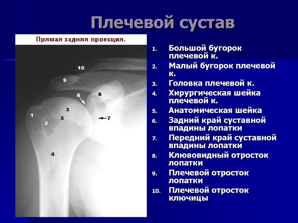 Бугорок плечевой кости