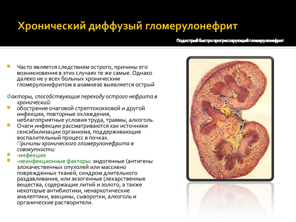 Презентация на тему гломерулонефрит