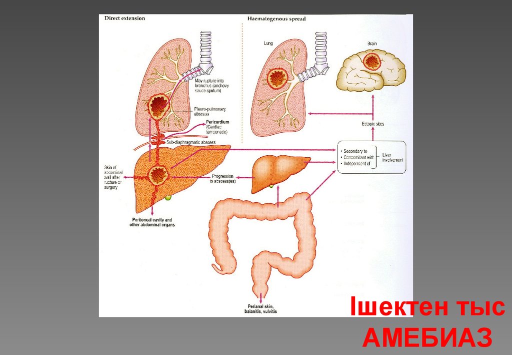 Стадия амебы поражающая толстый кишечник человека. Внекишечный амебиаз клиника. Дизентерийный амебиаз.