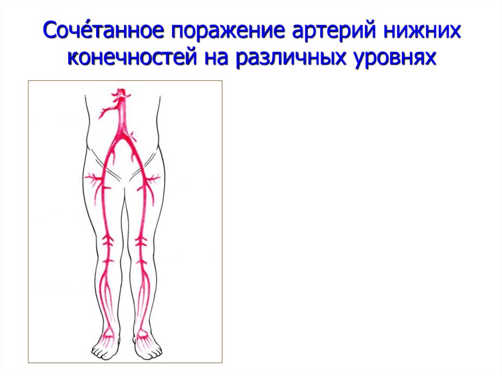 Анатомия артерий нижних конечностей схема для узи