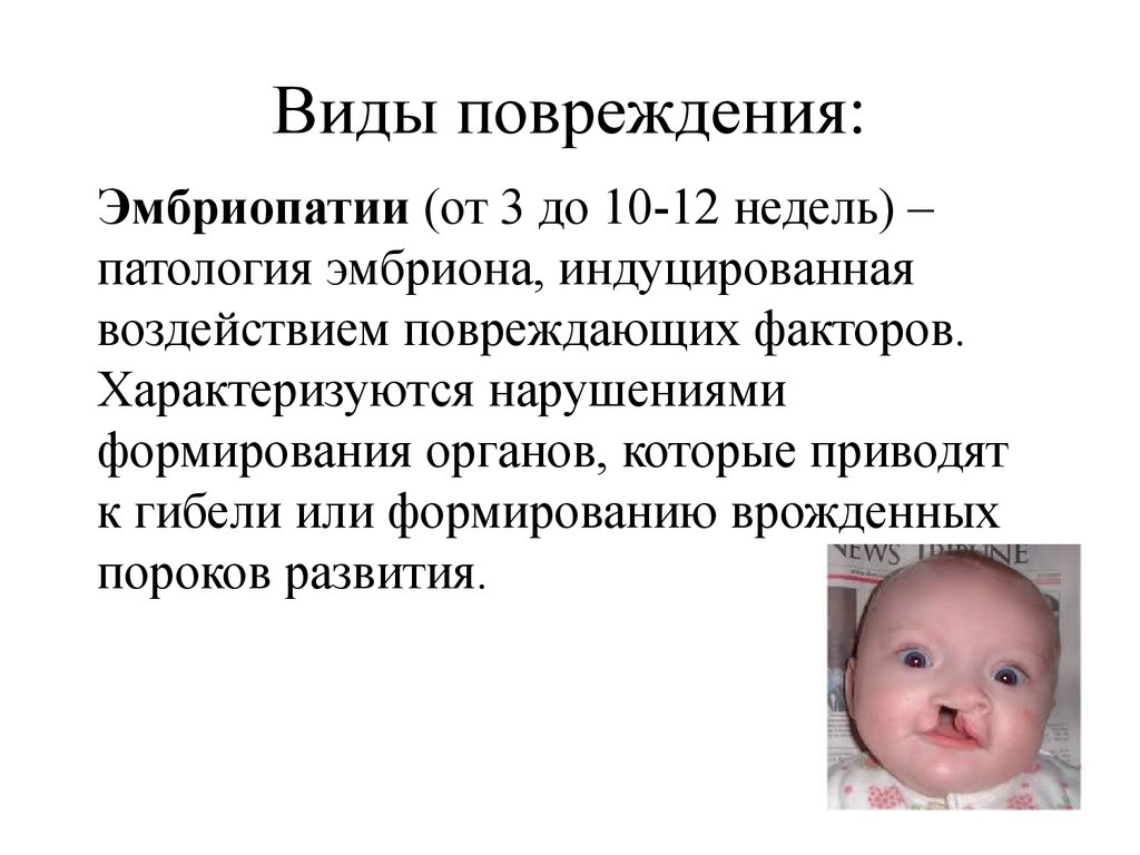 Патология отца. Патологии развития плода. Эмбриопатия патологии. Эмбриопатии новорожденных.