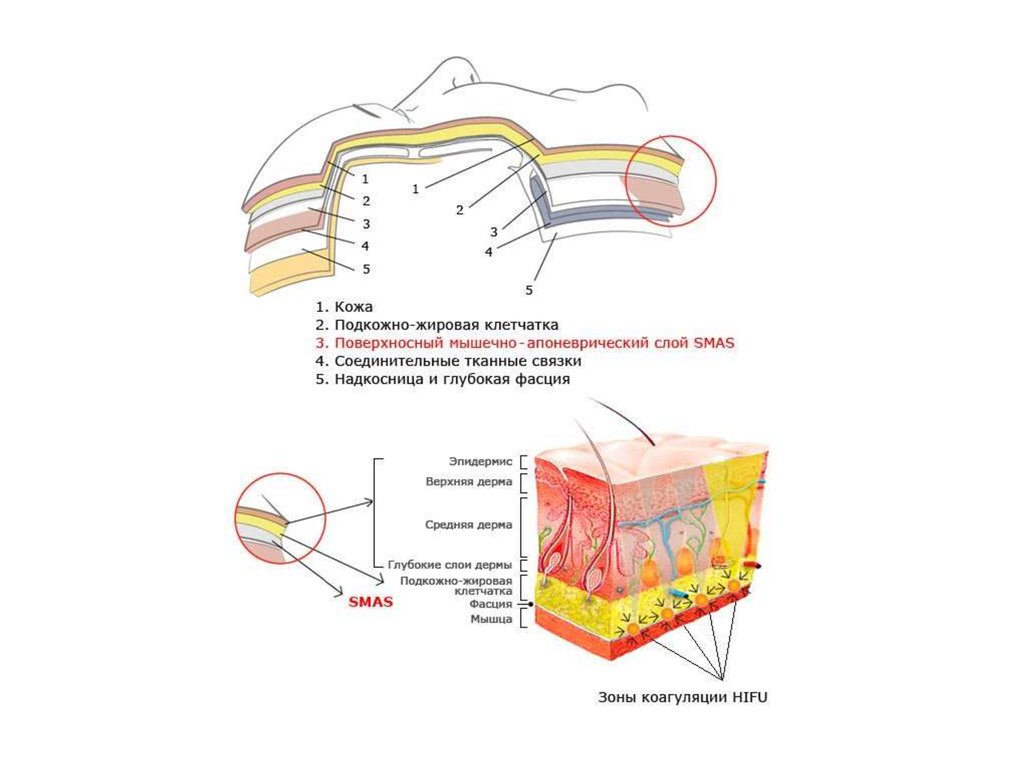 Подкожная кожа. Слои кожи подкожно жировая клетчатка. Смас слой кожи. Смас слой мышечно апоневротический. Подкожно жировая клетчатка лица анатомия.