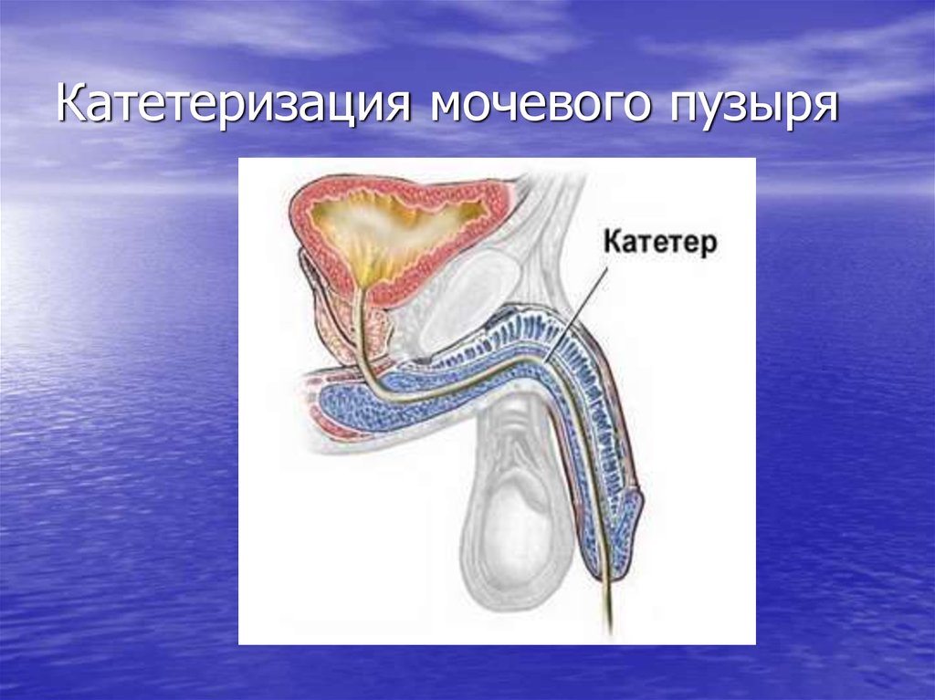 Мочеполовая система презентация