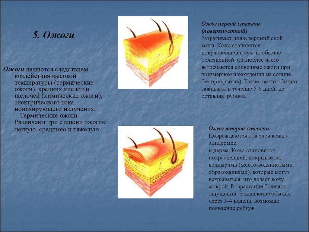 При ожоге третьей степени необходимо