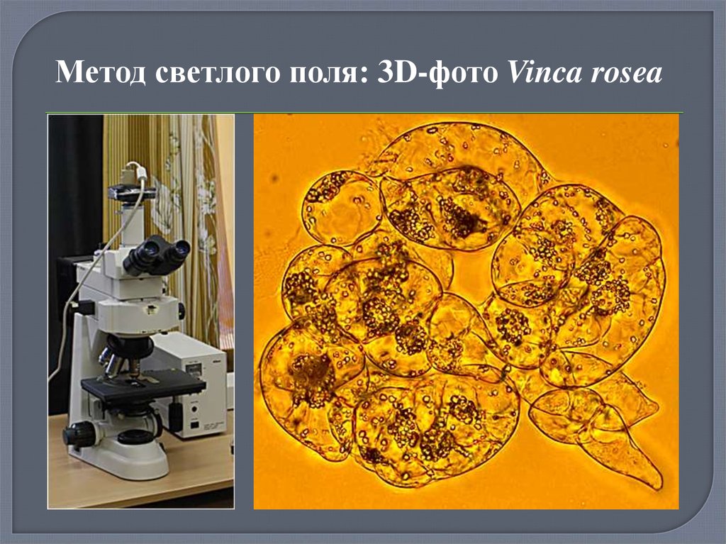 Поле микроскопа. Микроскопия в Светлом поле. Метод светлого и темного поля в микроскопии. Метод светлого поля в микроскопии. Методы светлого и темного поля в микроскопии.