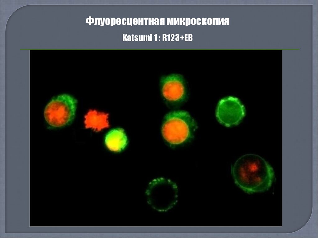 Флуоресцентная микроскопия описание метода. Флуоресцентная микроскопия описание. Метод флюоресценции. Метод флуорохромирования.