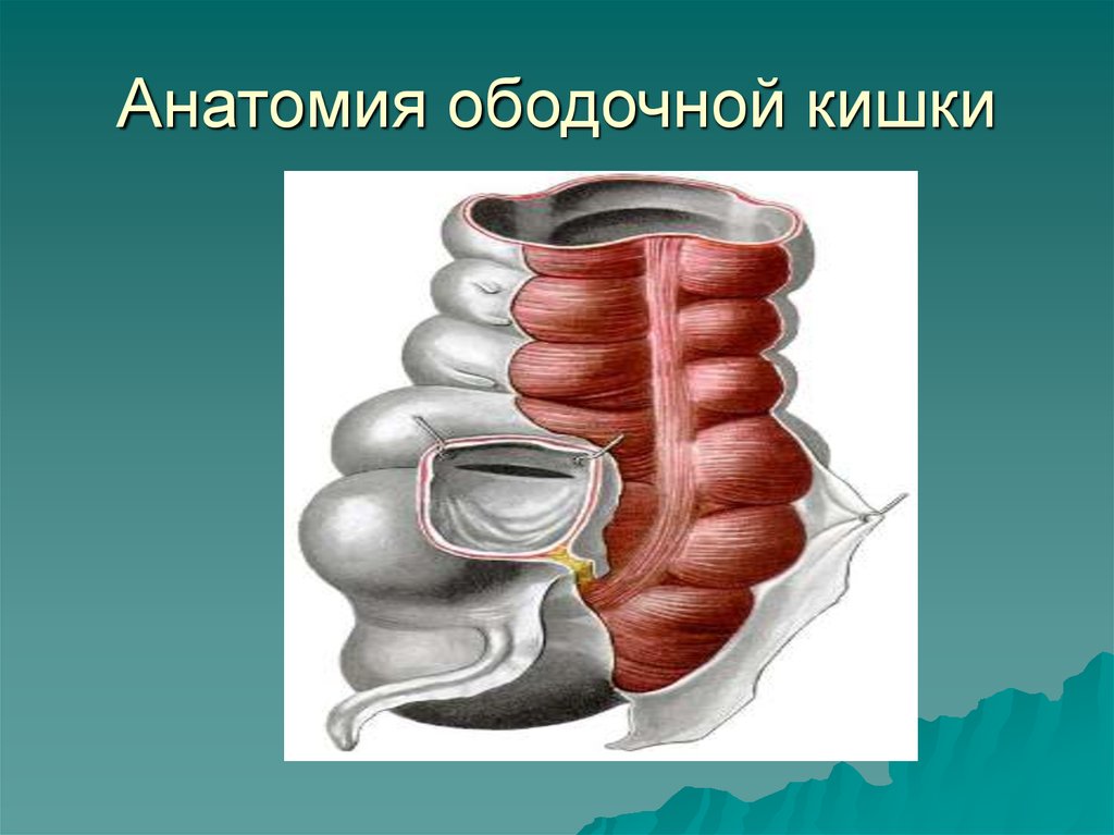 Дивертикулез толстой кишки. Ободочная кишка анатомия. Дивертикулы ободочной кишки. Ободоччная кишкаанатомия.