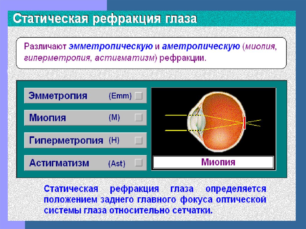 Расположение f оптической системы глаза схема близорукости