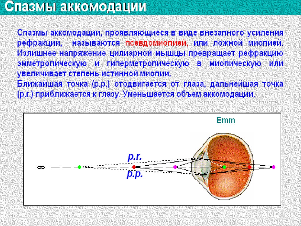 Объясните схему аккомодации хрусталика