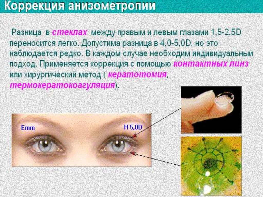 Исследование аккомодации зрения проект