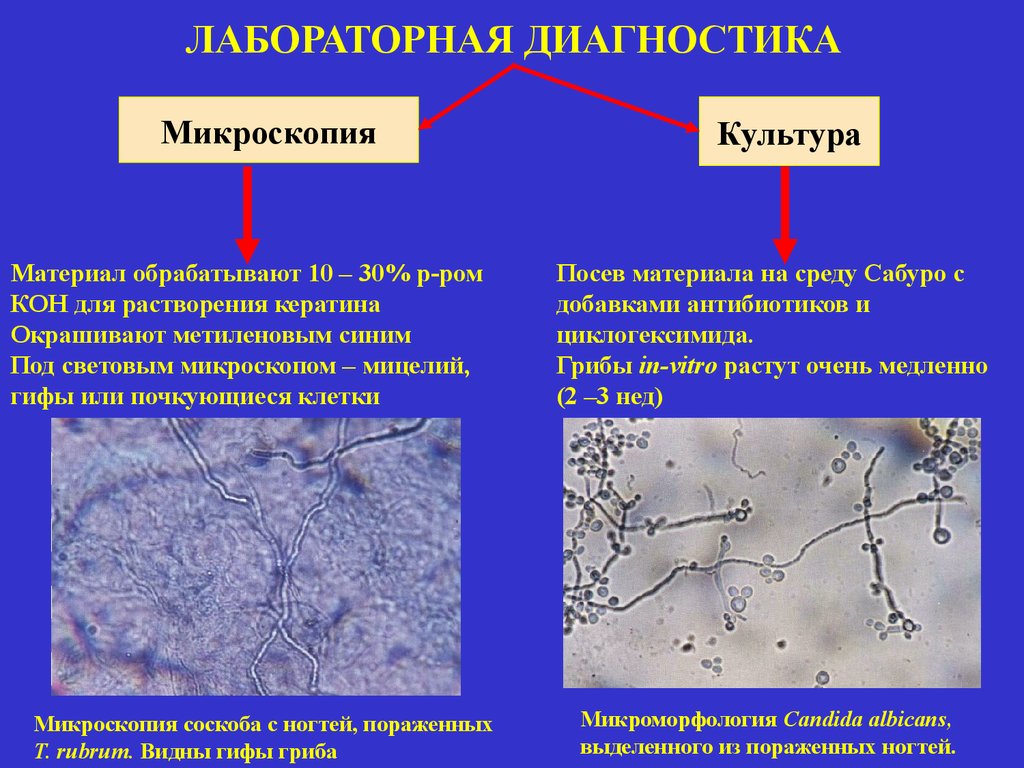 На коже обнаружены споры. Мицелий грибов кожи микроскопия. Микроскопический метод изучения грибов микробиология. Микроскопический метод микозов. Микроскопия патологического материала.