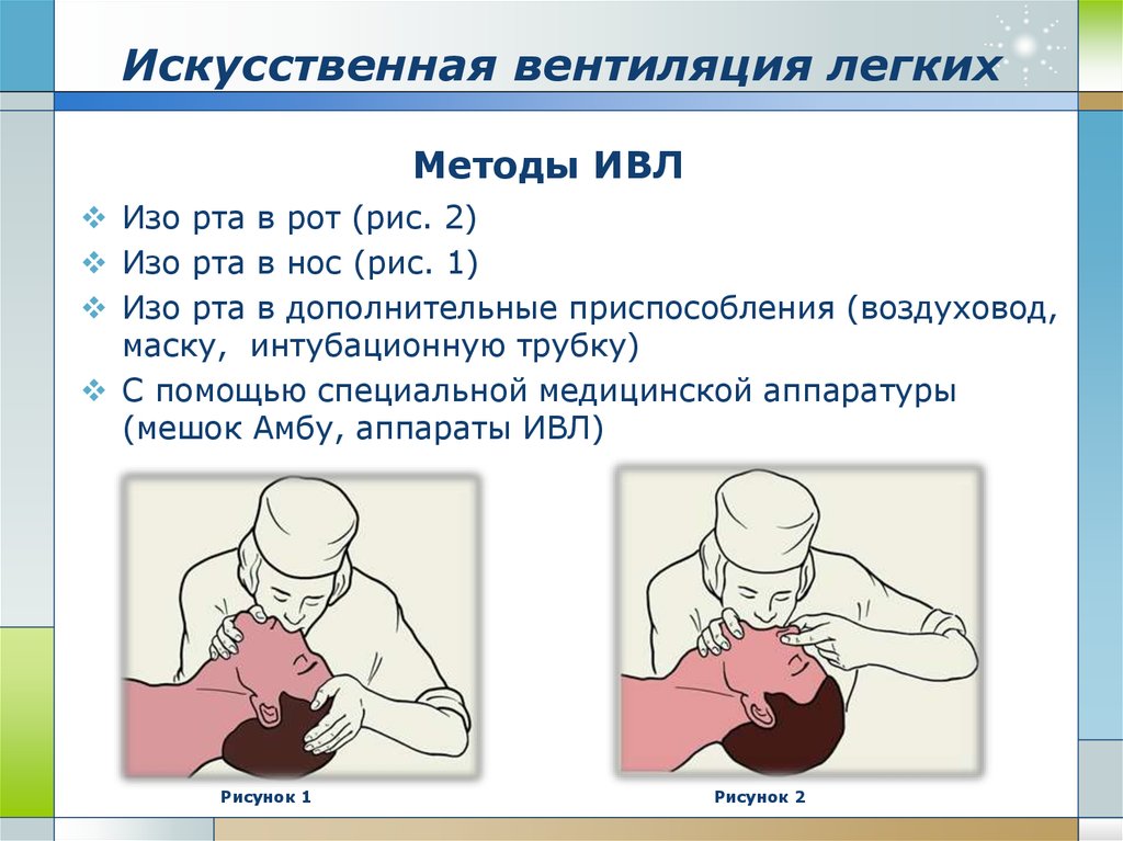 Правила вентиляции легких. При проведении ИВЛ (искусственной вентиляции легких) методом. Искусственная вентиляция легких способом «изо рта в нос». При проведении ИВЛ методом рот.
