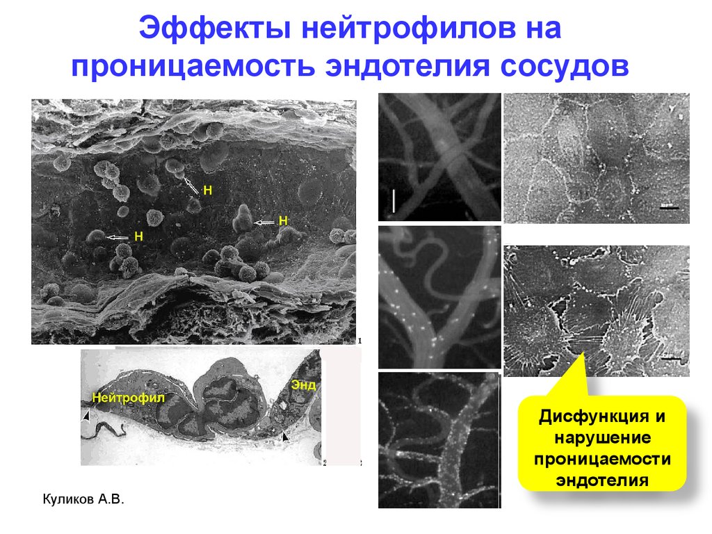 Эндотелия проницаемость. Дисфункция эндотелия. Эндотелий сосудов. Проницаемость капилляров.