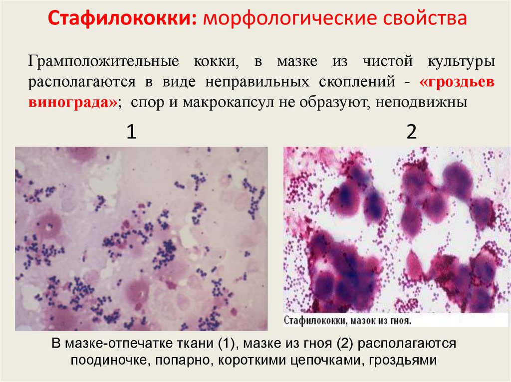 Staphylococcus aureus степени