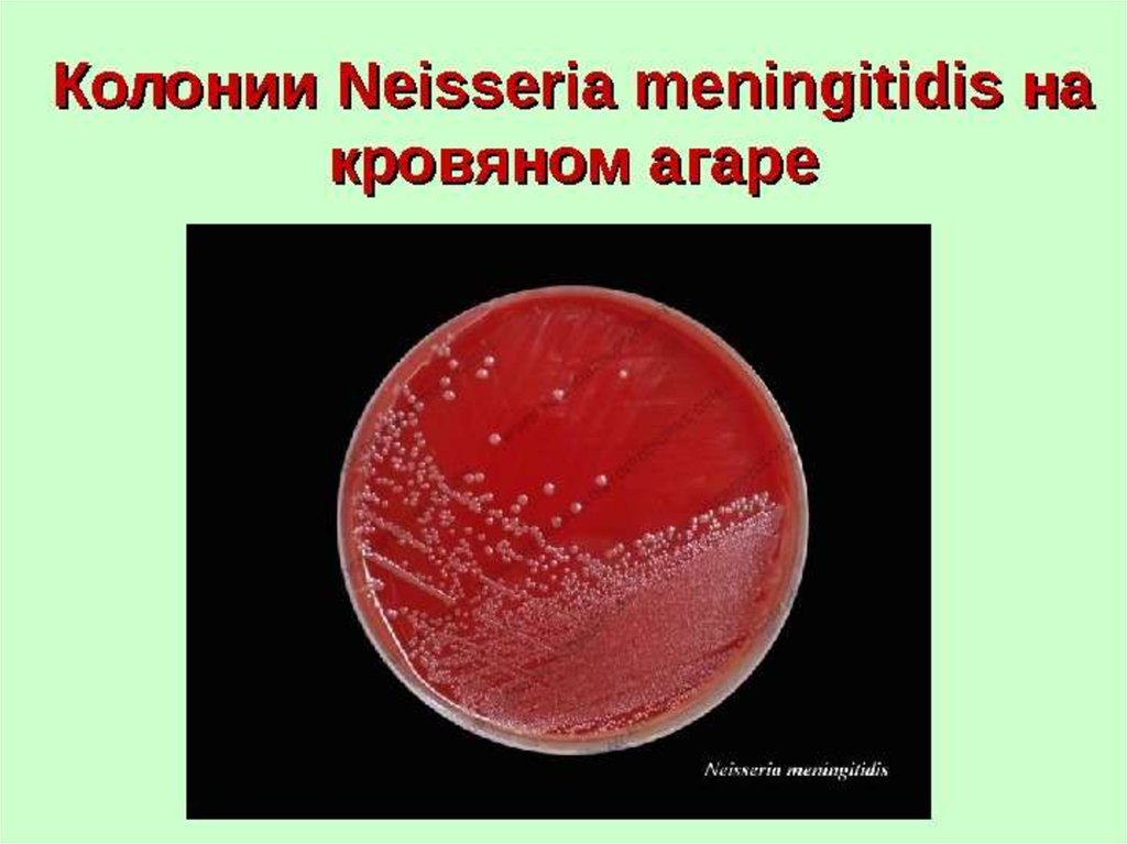 Chlamydia trachomatis neisseria gonorrhoeae. Нейссерия менингококк. Колонии менингококка на сывороточном агаре. Менингококк диплококк Neisseria meningitidis.