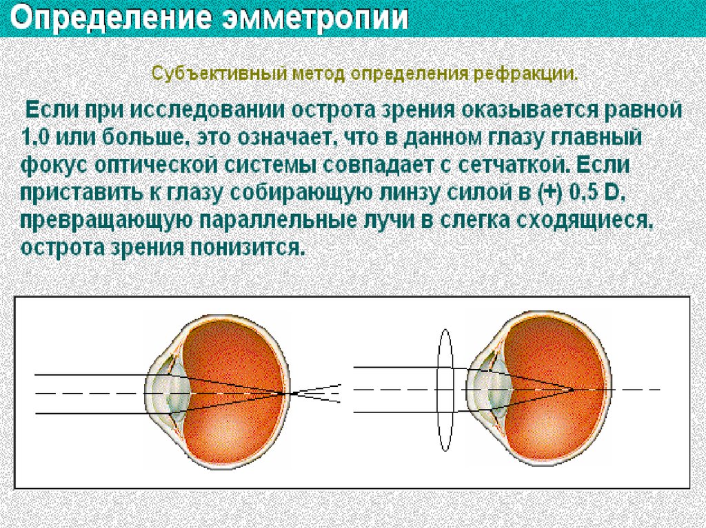 Коррекция аккомодации. Схему рефракции при эмметропии. Рефракция глаза эмметропия. При напряжении аккомодации рефракция. Острота зрения. Рефракция. Аккомодация..