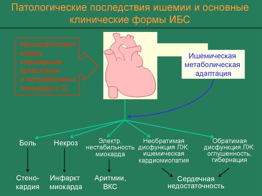 Клиническая картина ибс