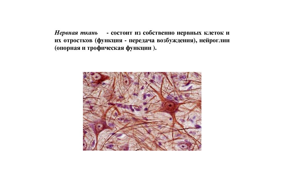 Нервная ткань состоит из собственно нервных клеток. Нервная ткань человека микропрепарат. Строение нервной ткани человека анатомия. Строение нервной ткани животного. Нервная ткань строение микроскоп.