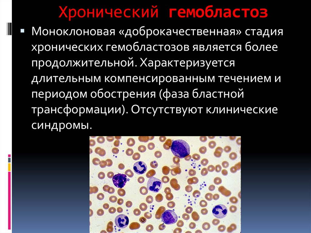 Гемобластозы это. Первично-локальные гемобластозы. Гемобластозы. Гемобластозы патологическая анатомия. Хронические гемобластозы.