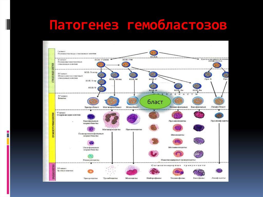 Патогенез лейкозов схема