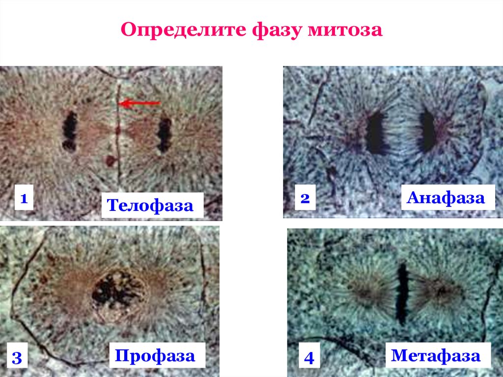 Митоз фото. Митоз в микроскопе по фазам. Телофаза митоза под микроскопом. Профаза митоза под микроскопом. Профаза под микроскопом.