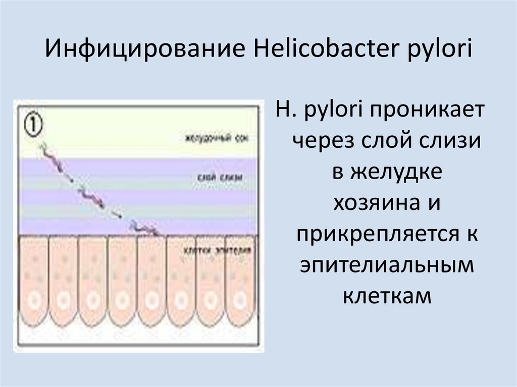 Инфицирование Helicobacter pylori