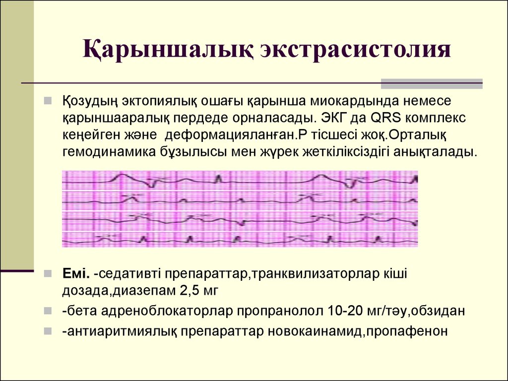 Экстрасистолия сердца причины